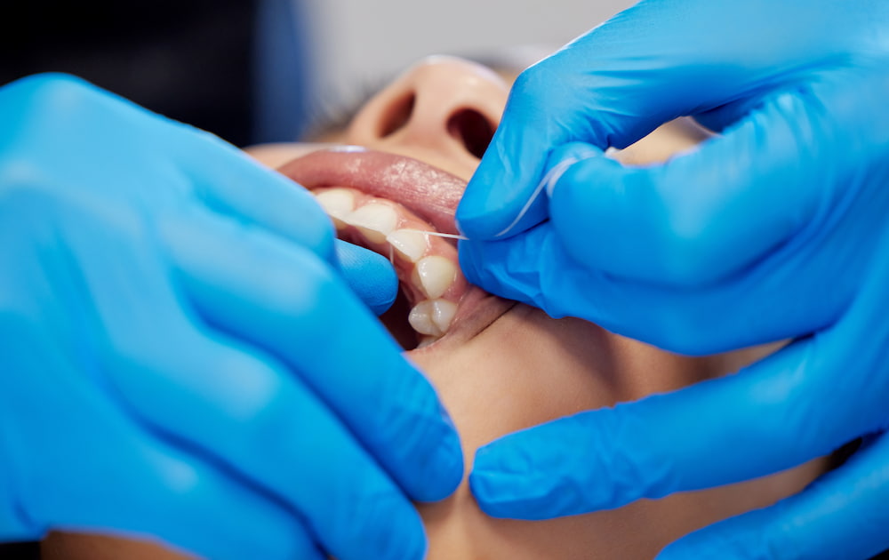 Qué hacer tras una fractura dental